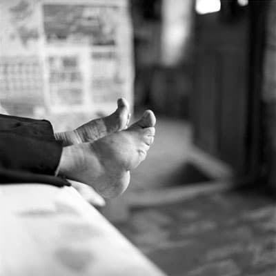 Bound feet, reportage fotografico su queste donne cinesi dai piedi fasciati